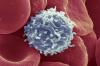 Учените са намерили начин, което води до Т-клетките, за да започне да се бори рака