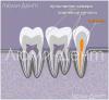 Как да намерите и лекувате зъбни канали в Lumident