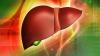 10 основни правила на здрав черен дроб