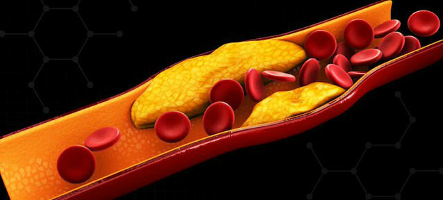 Холестеролът - cholesterin