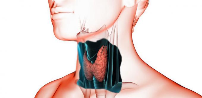 В случай на нарушения на щитовидната жлеза, се обърнете към лекар. Той ще се диагностицира (кръвни изследвания, палпация, ултразвук) и ще бъде в състояние да назначи конструктивно отношение.