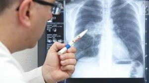 Лекарят сравнява радиационната експозиция с CT на белите дробове с радиацията в Хирошима