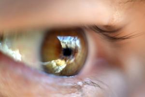 Отлепване на ретината на очите: как да се спаси зрението?