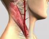 Блокирането на каротидни артерии: 8 истинските признаци
