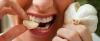 7 начина как да се отървете от миризмата на чесън уста