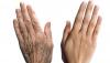 7 тайни гладка и младостта на кожата на ръцете