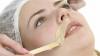 10 начина да допринесе за премахване на мустаци на горната му устна