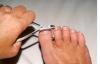 Как да се обръсне без проблеми твърди, удебелени нокти на краката. съвети читатели