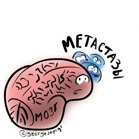метастазите в мозъка