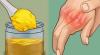 Как да се отървем от болки в ставите на ръцете