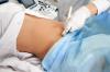 Колко често трябва да правите ултразвук по време на бременност, казва лекарят