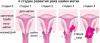 7 признаци на рак на маточната шийка, които жените често пренебрегват