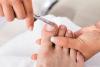 2 начина за изрязване на удебелени нокти на краката